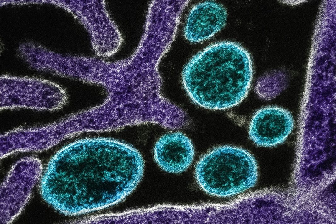 oms-considera-baixo-risco-de-disseminacao-do-virus-nipah-alem-da-india