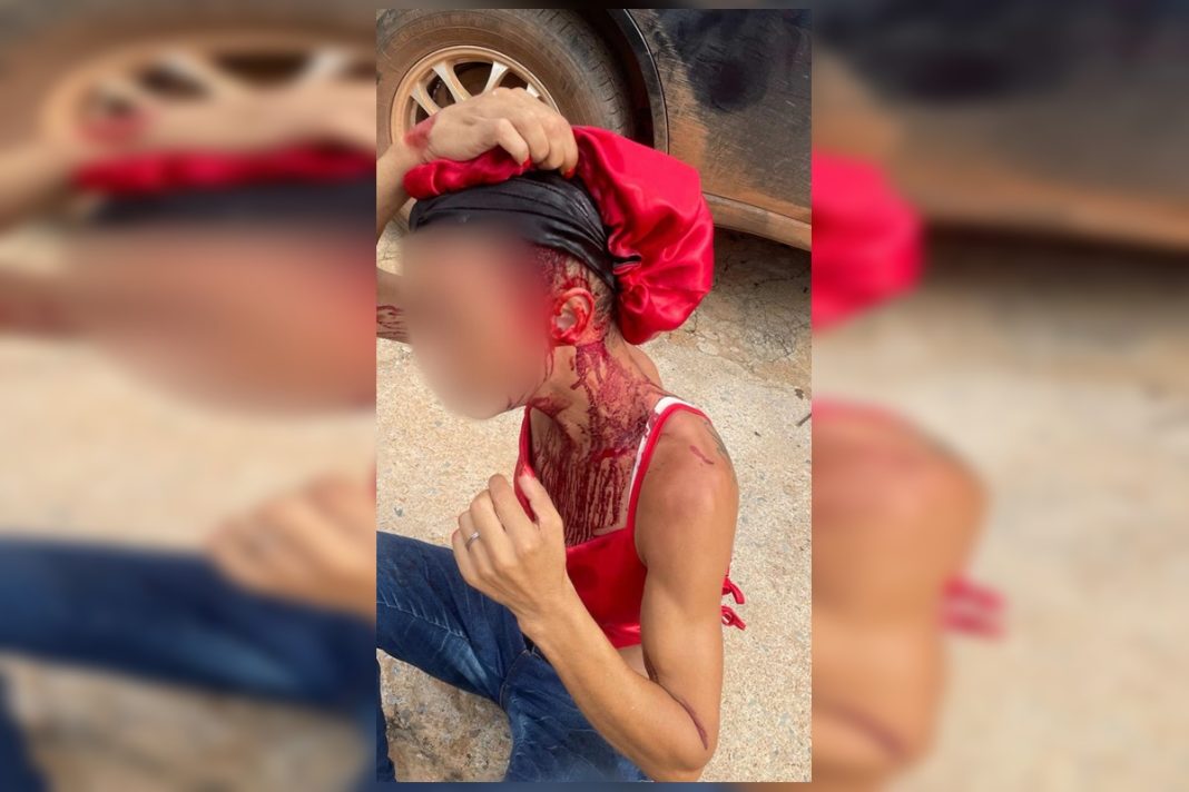 mulher-trans-e-brutalmente-agredida-com-barra-de-ferro-por-homem-no-df