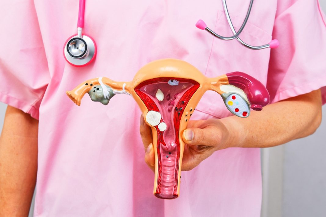 ginecologista-explica-sintomas-e-prevencao-do-cancer-de-colo-de-utero