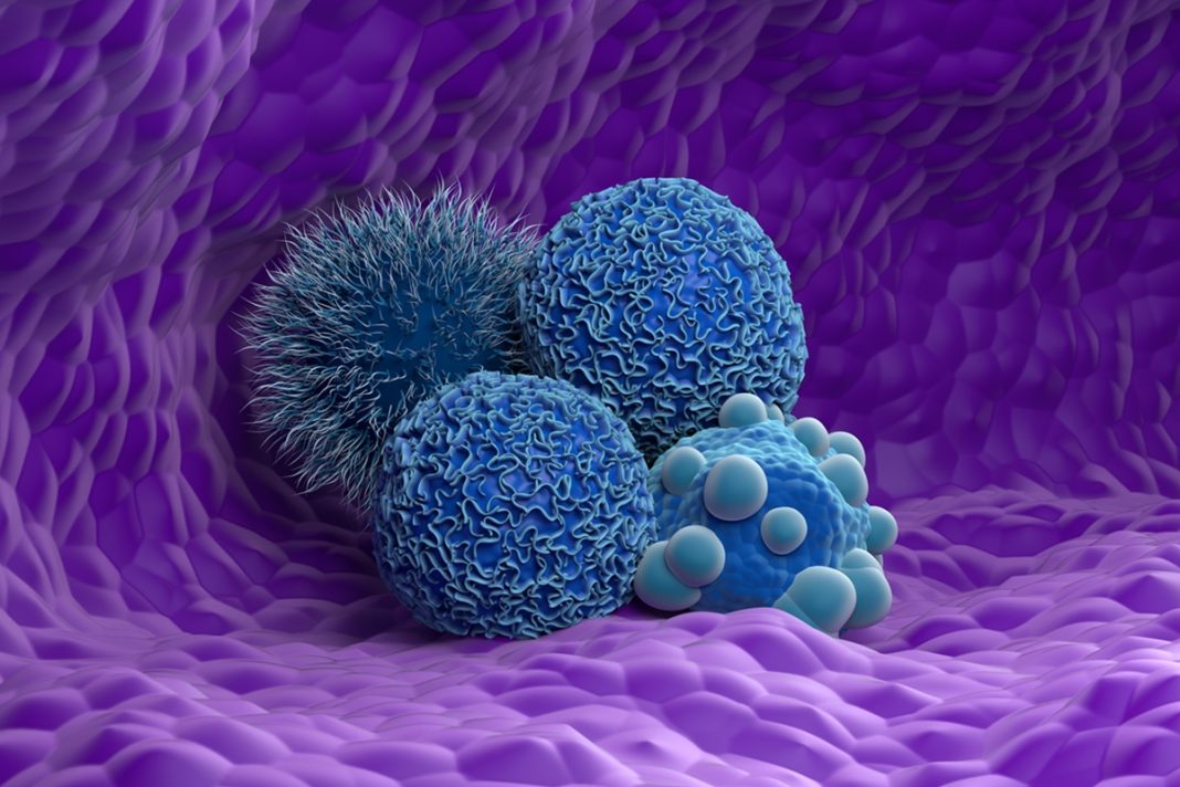 os-6-tipos-de-cancer-que-mais-avancam-entre-jovens,-segundo-harvard