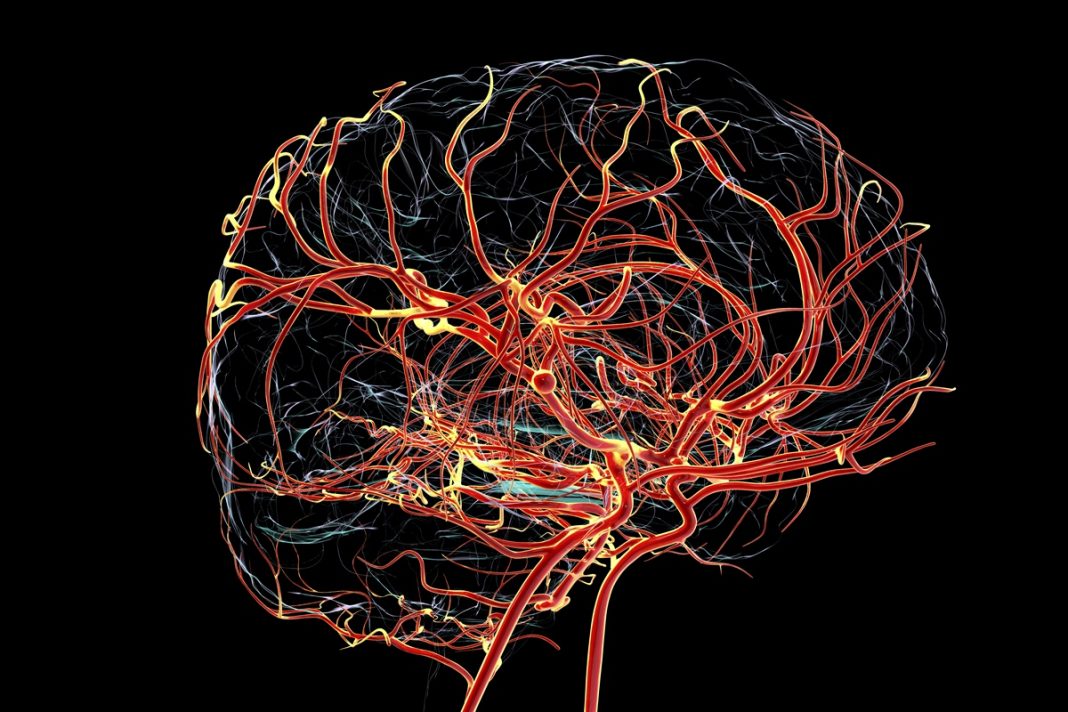 alzheimer-pode-comecar-com-a-queda-do-fluxo-sanguineo,-sugere-estudo