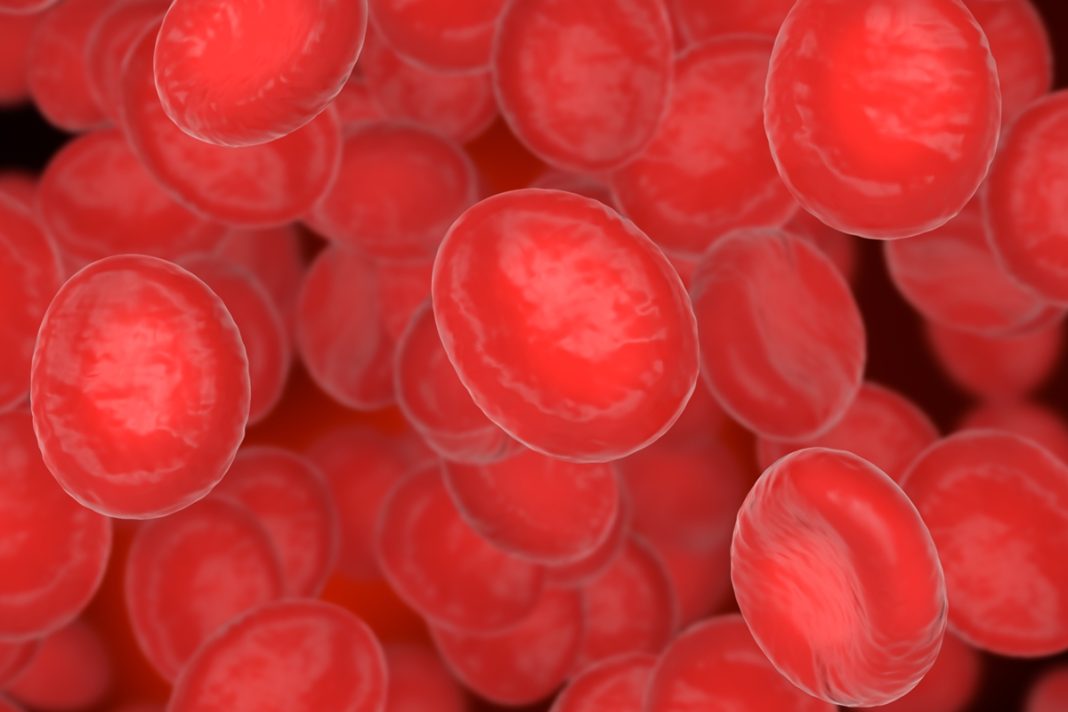 medico-alerta-que-anemia-pode-ser-o-1o-sinal-do-cancer-de-intestino