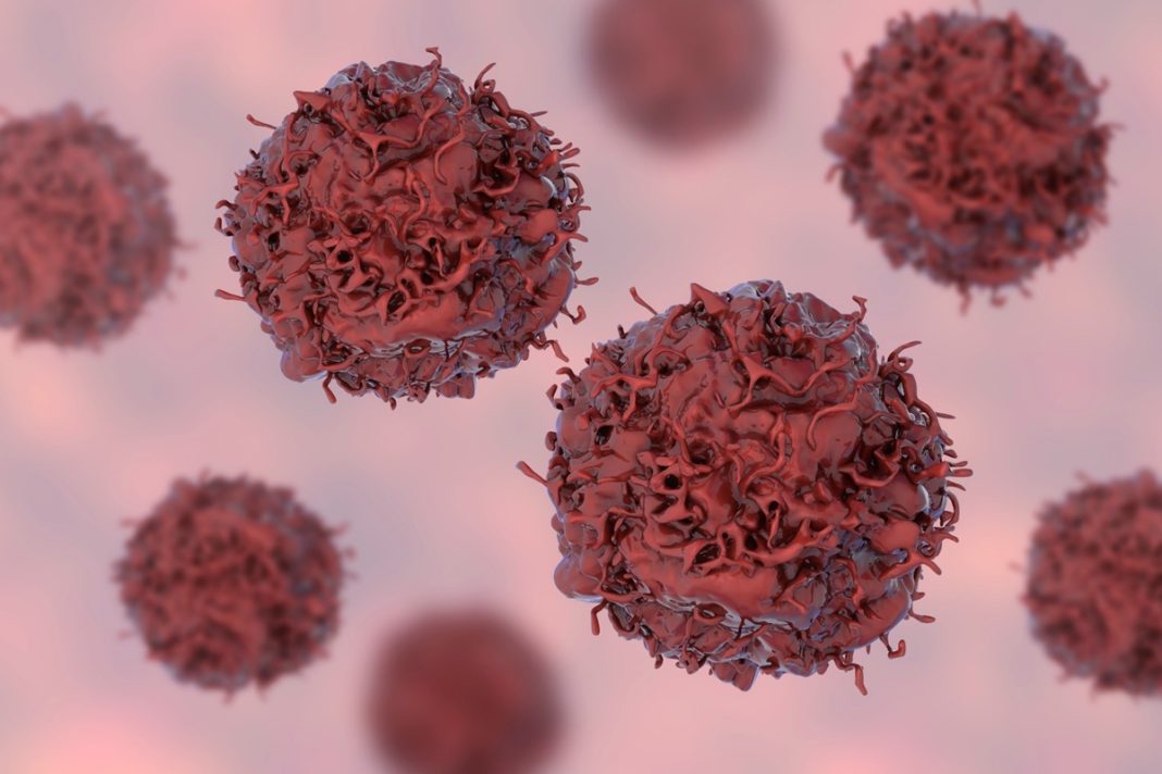 oncologistas-alertam-para-7-habitos-que-aumentam-o-risco-de-cancer