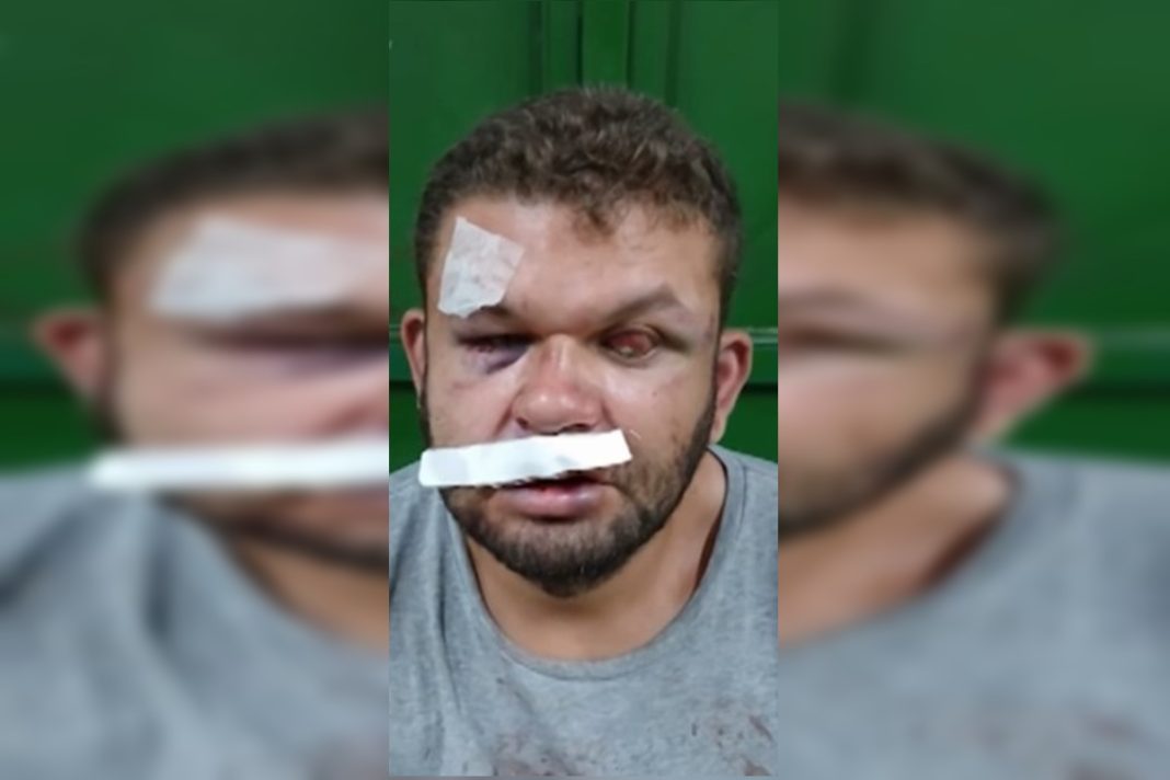homem-cego-e-irmao-sao-agredidos-durante-discussao-por-marmita-extra