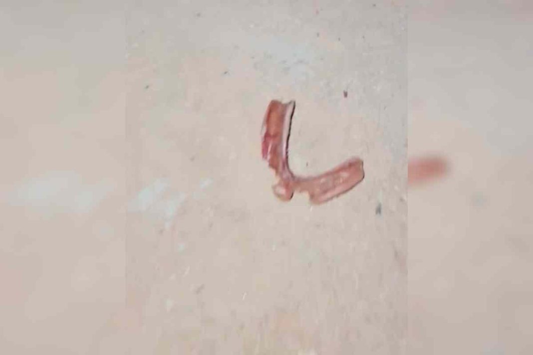 sangue-e-dentadura-no-chao:-cena-brutal-revela-morte-de-italiano-no-df.-veja-video