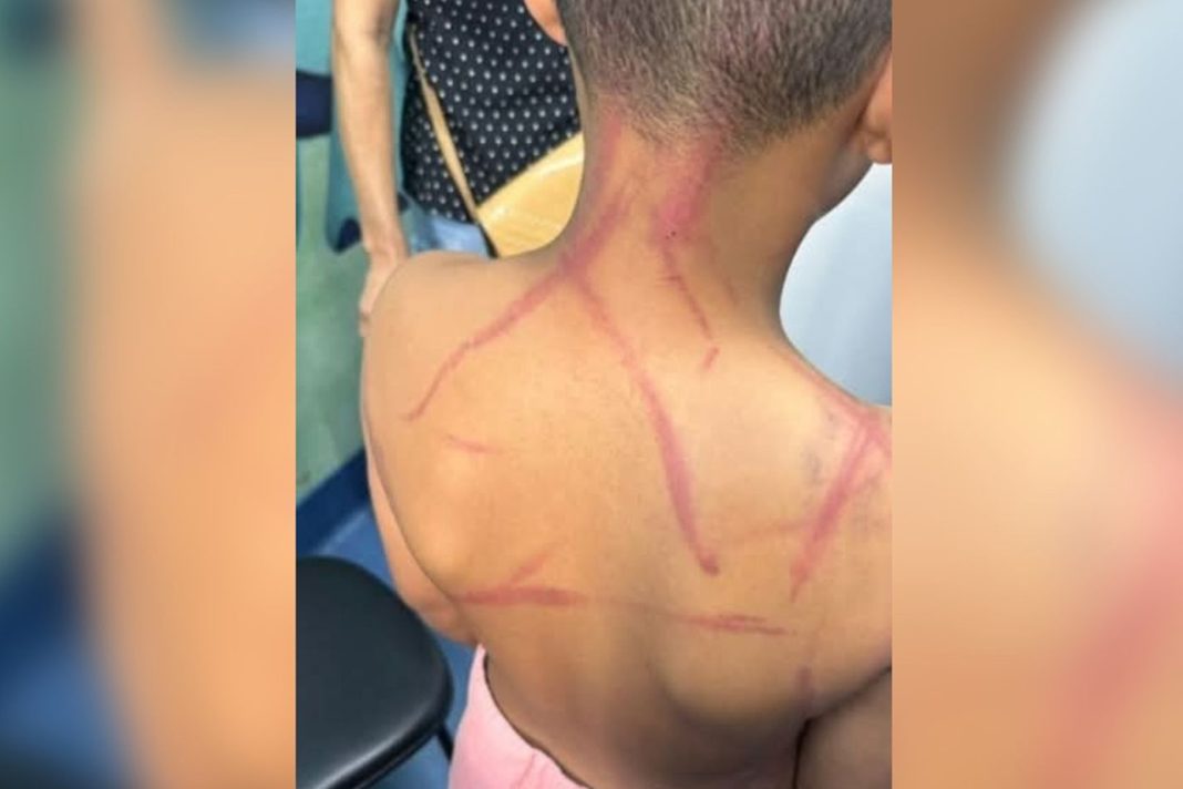 rj:-pastores-sao-presos-suspeitos-de-torturar-crianca-de-9-anos