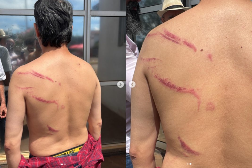 vereador-do-pt-preso-em-ato-do-mst-acusa-pmgo-de-agressao-fisica