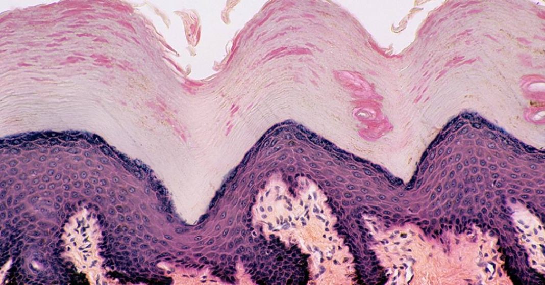 quantas-celulas-de-pele-uma-pessoa-solta-por-hora?