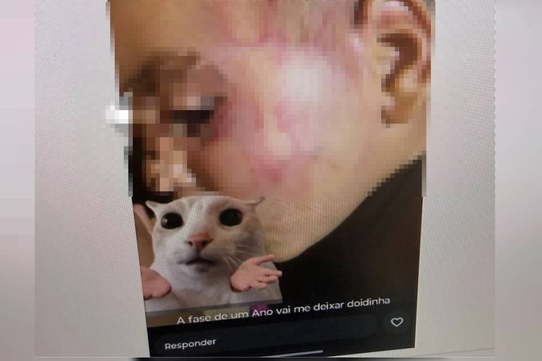 mae-posta-foto-de-filho-espancado-e-padrasto-e-preso:-“a-fase-de-1-ano-vai-me-deixar-doida”.-veja-video