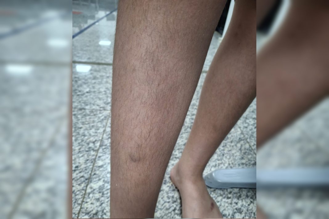 aluno-e-agredido-por-10-criancas-dentro-de-colegio-militar-do-df