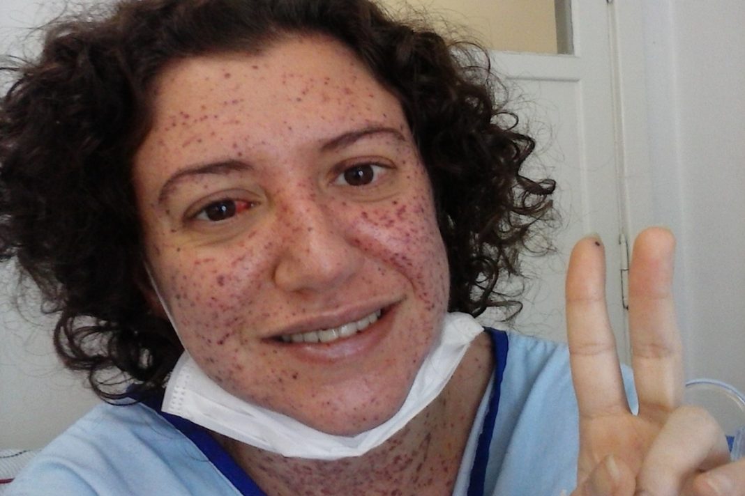 “vivo-com-uma-bomba-relogio-dentro-de-mim”,-diz-mulher-com-doenca-rara
