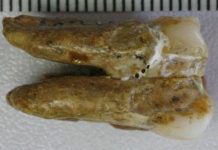 Dentes de 400 mil anos apontam cruzamento entre denisovanos e Homo erectus dentes-de-400-mil-anos-apontam-cruzamento-entre-denisovanos-e-homo-erectus