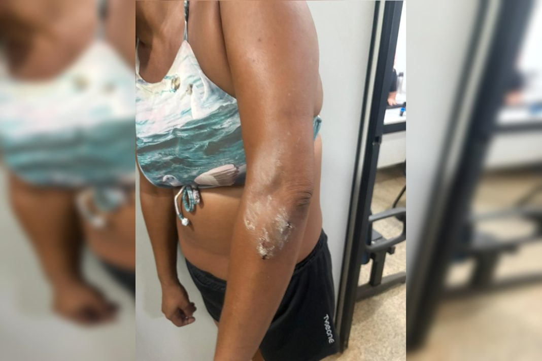 homem-arremessa-pedras-na-sogra-e-e-preso-por-violencia-domestica