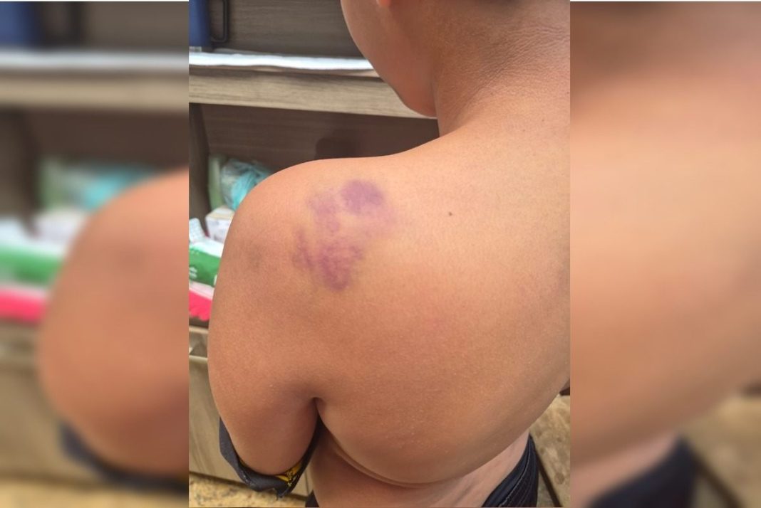 aluno-de-12-anos-e-espancado-apos-ser-xingado-de-“neguinho”-em-escola-do-df