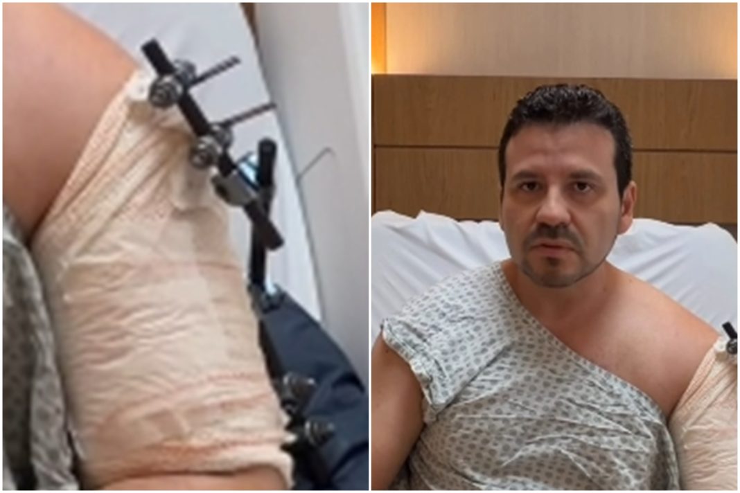medico-em-carro-blindado-cai-em-golpe-do-retrovisor-e-acaba-baleado-no-rio