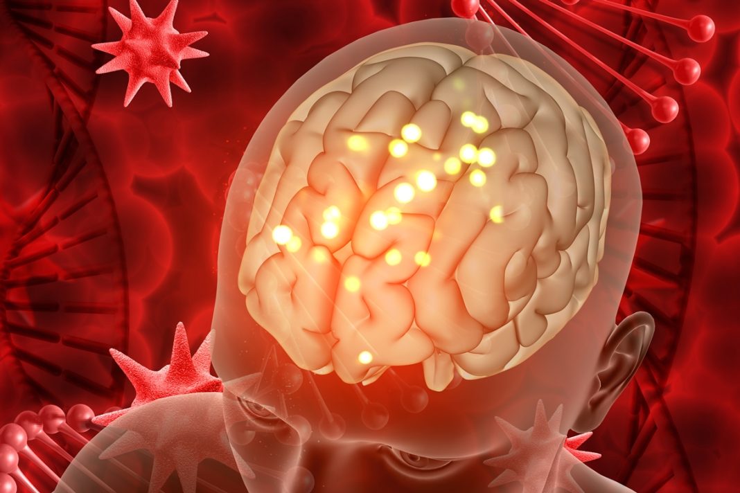 cancer-cria-especie-de-“ninho”-enquanto-cresce-no-cerebro,-aponta-estudo