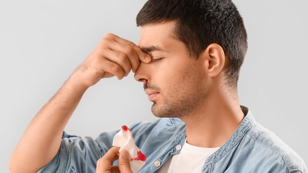 sangramento-nasal:-quando-e-preciso-procurar-um-medico?