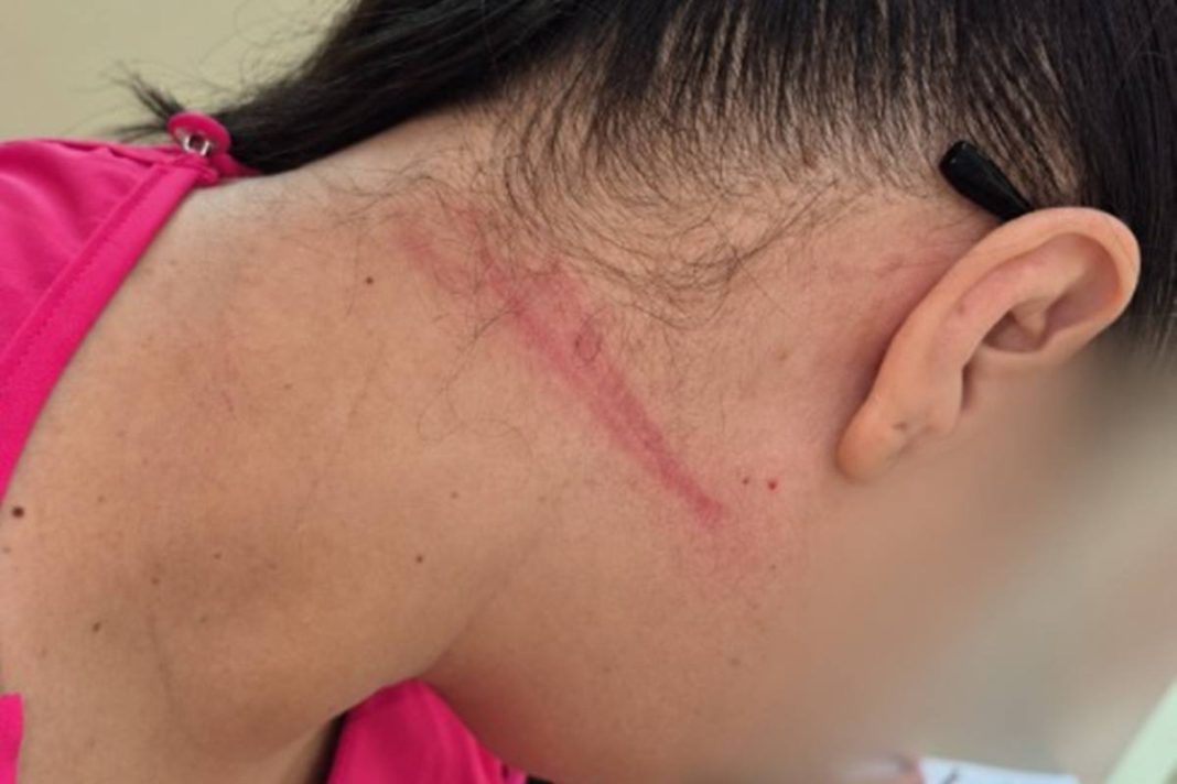 fotos:-tecnica-de-enfermagem-enforcada-em-upa-teve-hematomas-no-pescoco