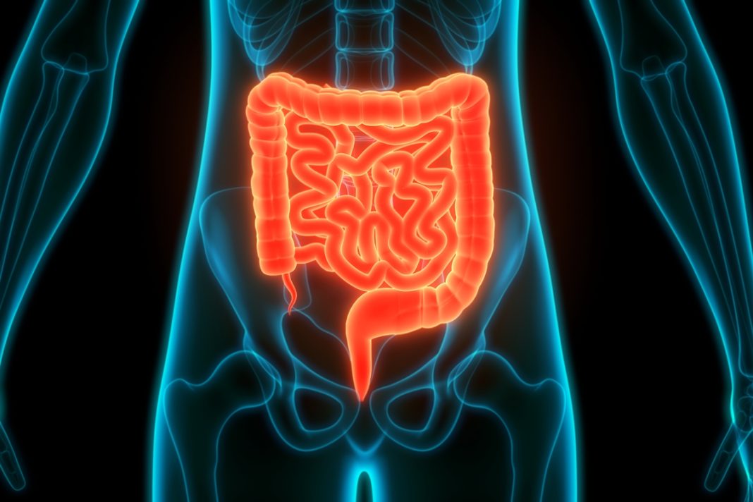 estudo-descobre-como-bacteria-intestinal-pode-favorecer-cancer-de-colon