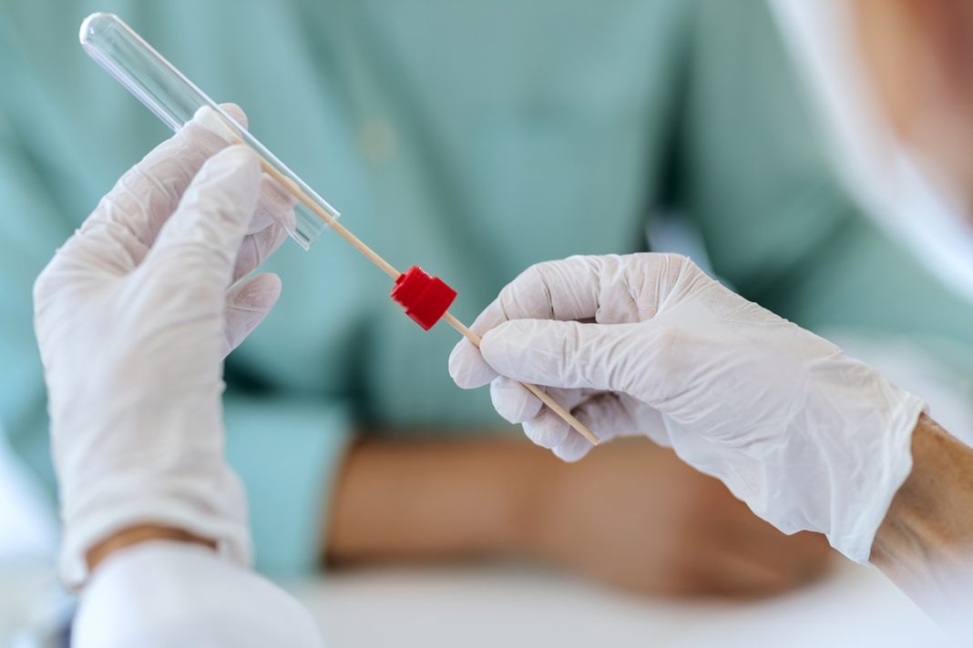 teste-com-cotonete-pode-evitar-biopsias-em-casos-suspeitos-de-cancer